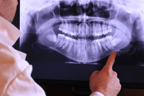 Best Dental Abscess Treatment in White Oak, OH